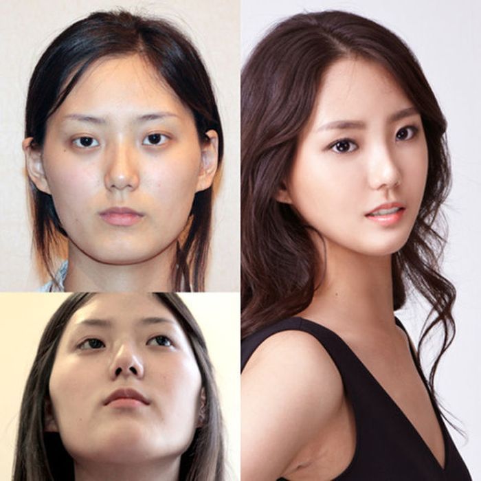 【画像】めっちゃ美人の韓国美女の ”整形前” ヤバすぎ ポッカキット