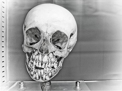 child-skull-with-two-rows-of-teeth