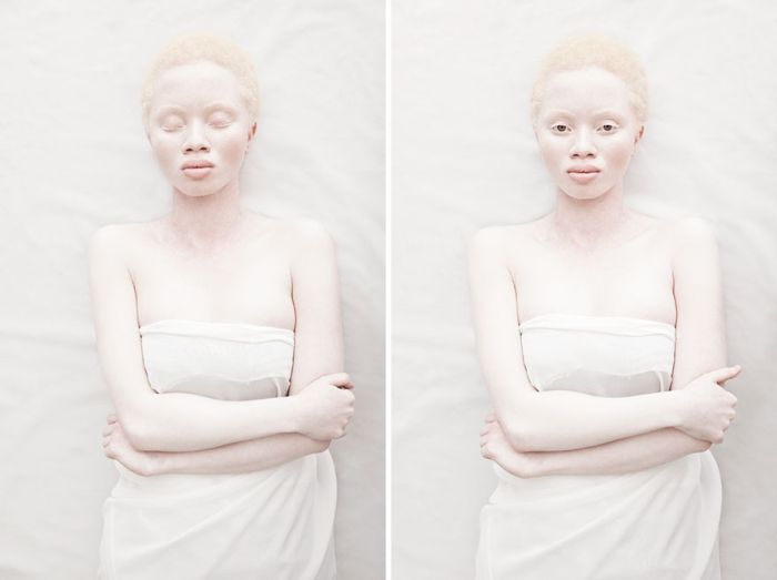 albino_people_03