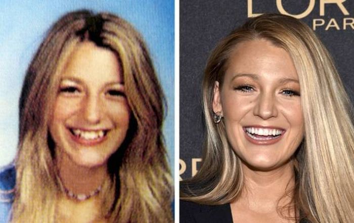 celebrities_before_and_after_08