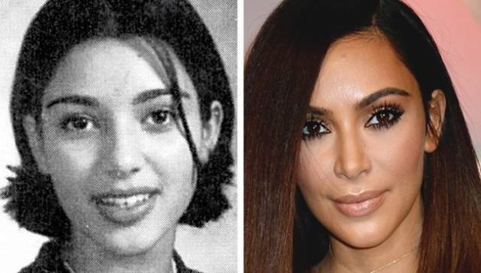celebrities_before_and_after_10