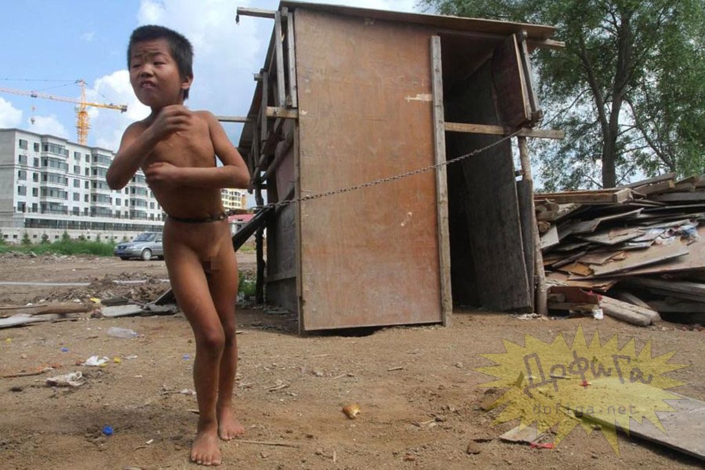 中国で3年間もの間、【鎖でつながれたまま】生活していた12歳の少年。[6]images ポッカキット